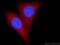 Phosphoglucomutase-1 antibody, 66105-1-Ig, Proteintech Group, Immunofluorescence image 