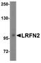 Leucine Rich Repeat And Fibronectin Type III Domain Containing 2 antibody, A11623, Boster Biological Technology, Western Blot image 