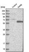 Retinoic Acid Receptor Beta antibody, NBP1-81776, Novus Biologicals, Western Blot image 