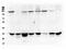 Protein Kinase AMP-Activated Non-Catalytic Subunit Beta 2 antibody, M05077, Boster Biological Technology, Western Blot image 