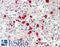 Cytidine deaminase antibody, LS-B11918, Lifespan Biosciences, Immunohistochemistry paraffin image 