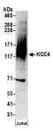 Solute carrier family 12 member 7 antibody, A304-443A, Bethyl Labs, Western Blot image 