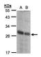 Ribosyldihydronicotinamide dehydrogenase [quinone] antibody, GTX105899, GeneTex, Western Blot image 