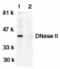 Deoxyribonuclease-2-alpha antibody, TA305979, Origene, Western Blot image 