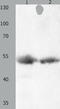 Mitogen-Activated Protein Kinase 8 antibody, TA322056, Origene, Western Blot image 