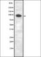 Disrupted In Renal Carcinoma 1 antibody, orb335252, Biorbyt, Western Blot image 