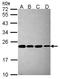 Proteasome Subunit Beta 5 antibody, GTX104687, GeneTex, Western Blot image 