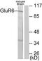 Metabotropic glutamate receptor 6 antibody, TA313975, Origene, Western Blot image 