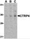 C1q And TNF Related 4 antibody, 3567, ProSci, Western Blot image 