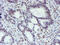 WW Domain Containing Transcription Regulator 1 antibody, M02672-1, Boster Biological Technology, Immunohistochemistry paraffin image 