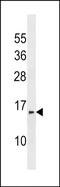 InaF Motif Containing 1 antibody, PA5-49106, Invitrogen Antibodies, Western Blot image 