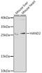 Heart And Neural Crest Derivatives Expressed 2 antibody, 22-655, ProSci, Western Blot image 