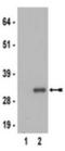 Ribosomal Protein S6 antibody, NBP2-29667, Novus Biologicals, Western Blot image 