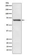 Replication Protein A1 antibody, M01317-1, Boster Biological Technology, Western Blot image 