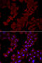 Chaperonin Containing TCP1 Subunit 4 antibody, 22-304, ProSci, Immunofluorescence image 