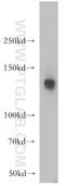 U2 SnRNP Associated SURP Domain Containing antibody, 21399-1-AP, Proteintech Group, Western Blot image 