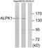 Alpha Kinase 1 antibody, TA315825, Origene, Western Blot image 