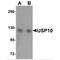 Ubiquitin Specific Peptidase 10 antibody, MBS150568, MyBioSource, Western Blot image 