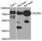 Potassium voltage-gated channel subfamily D member 2 antibody, A6203, ABclonal Technology, Western Blot image 