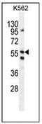 Leucine Rich Repeat, Ig-Like And Transmembrane Domains 1 antibody, AP52524PU-N, Origene, Western Blot image 