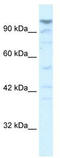 La Ribonucleoprotein Domain Family Member 1 antibody, TA335599, Origene, Western Blot image 