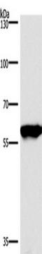 Serine/threonine-protein phosphatase 2B catalytic subunit alpha isoform antibody, TA349733, Origene, Western Blot image 