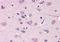 Melanotransferrin antibody, orb88055, Biorbyt, Immunohistochemistry paraffin image 