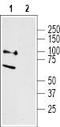 p75 ICD antibody, TA328684, Origene, Western Blot image 