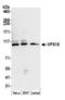 VPS18 Core Subunit Of CORVET And HOPS Complexes antibody, A305-543A, Bethyl Labs, Western Blot image 