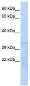 Proteasome subunit beta type-1 antibody, TA342163, Origene, Western Blot image 