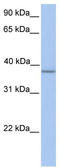 Alpha-1,4-N-Acetylglucosaminyltransferase antibody, TA342000, Origene, Western Blot image 