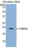 Fatty Acid Binding Protein 9 antibody, LS-C293838, Lifespan Biosciences, Western Blot image 