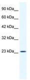 BTB/POZ domain-containing protein KCTD11 antibody, TA341730, Origene, Western Blot image 