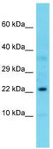 60S ribosomal protein L23a antibody, TA344049, Origene, Western Blot image 