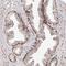 Zinc Finger Protein 502 antibody, NBP1-82298, Novus Biologicals, Immunohistochemistry frozen image 