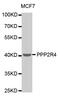 Protein Phosphatase 2 Phosphatase Activator antibody, MBS127891, MyBioSource, Western Blot image 