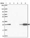 Synaptoporin antibody, NBP2-38932, Novus Biologicals, Western Blot image 