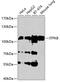 Inositol-trisphosphate 3-kinase B antibody, GTX65942, GeneTex, Western Blot image 
