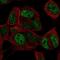 T Cell Leukemia Homeobox 3 antibody, NBP2-68618, Novus Biologicals, Immunocytochemistry image 