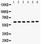 Solute Carrier Family 1 Member 2 antibody, PA5-80011, Invitrogen Antibodies, Western Blot image 