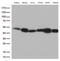 Fc Fragment Of IgG Receptor IIa antibody, M01450-1, Boster Biological Technology, Western Blot image 