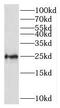 60S ribosomal protein L10 antibody, FNab07408, FineTest, Western Blot image 