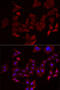 Nephrocystin 1 antibody, 22-397, ProSci, Immunofluorescence image 