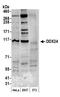 DEAD-Box Helicase 24 antibody, A300-697A, Bethyl Labs, Western Blot image 