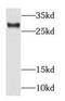 Ras-related protein Rab-34 antibody, FNab07018, FineTest, Western Blot image 