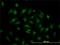 Transcription Factor 19 antibody, H00006941-M01, Novus Biologicals, Immunocytochemistry image 