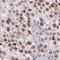 Zinc Finger Protein 414 antibody, HPA053769, Atlas Antibodies, Immunohistochemistry frozen image 