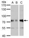 DM1 Protein Kinase antibody, GTX101248, GeneTex, Western Blot image 
