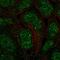 Ankyrin Repeat Domain 22 antibody, HPA012922, Atlas Antibodies, Immunocytochemistry image 