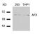 Forkhead Box O4 antibody, GTX50500, GeneTex, Western Blot image 